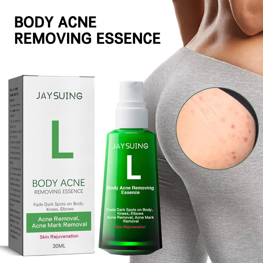 Jaysuing Acne Spot Lightening Serum for Skin Care